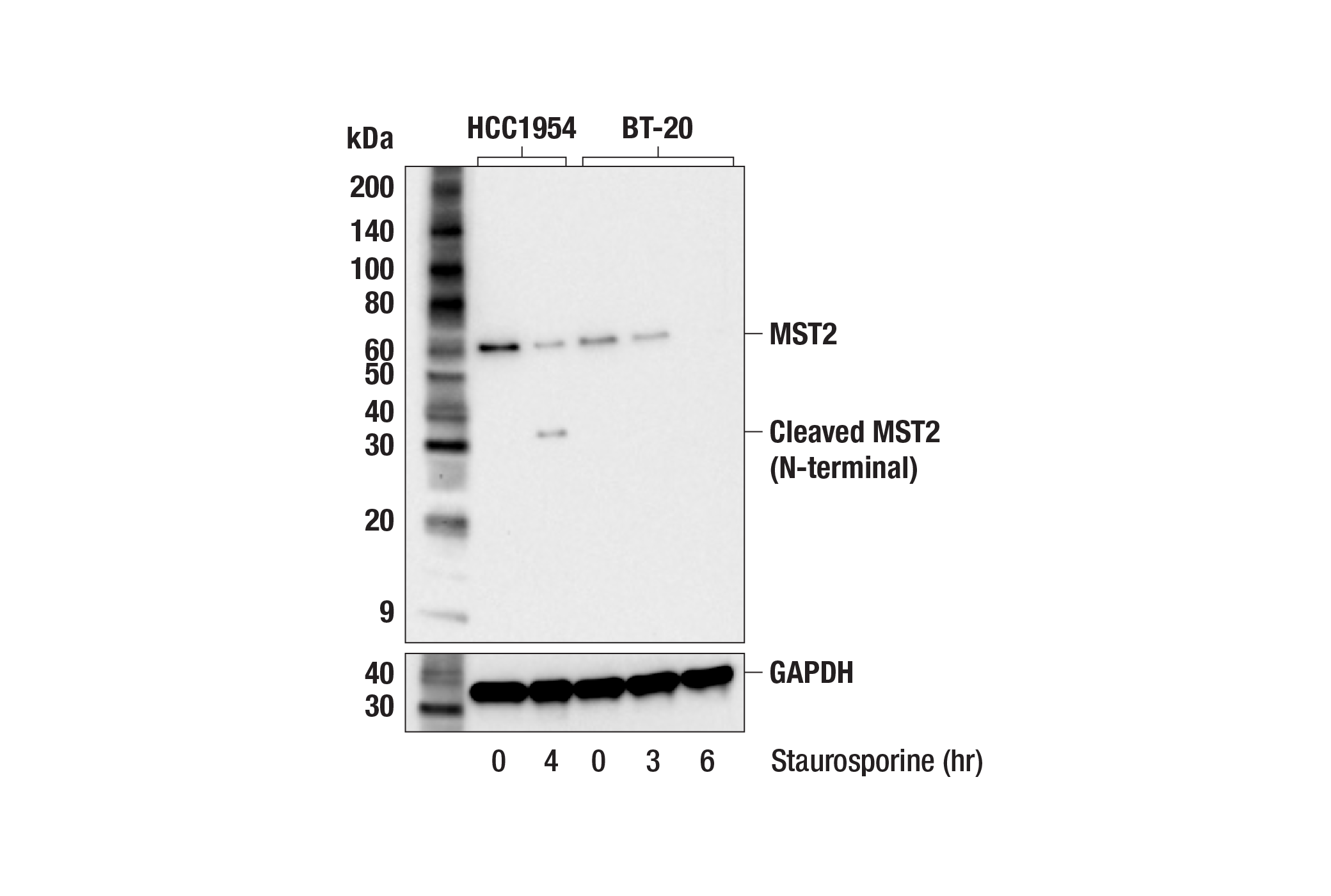 Western Blotting Image 3: MST2 (F4C3I) Rabbit Monoclonal Antibody