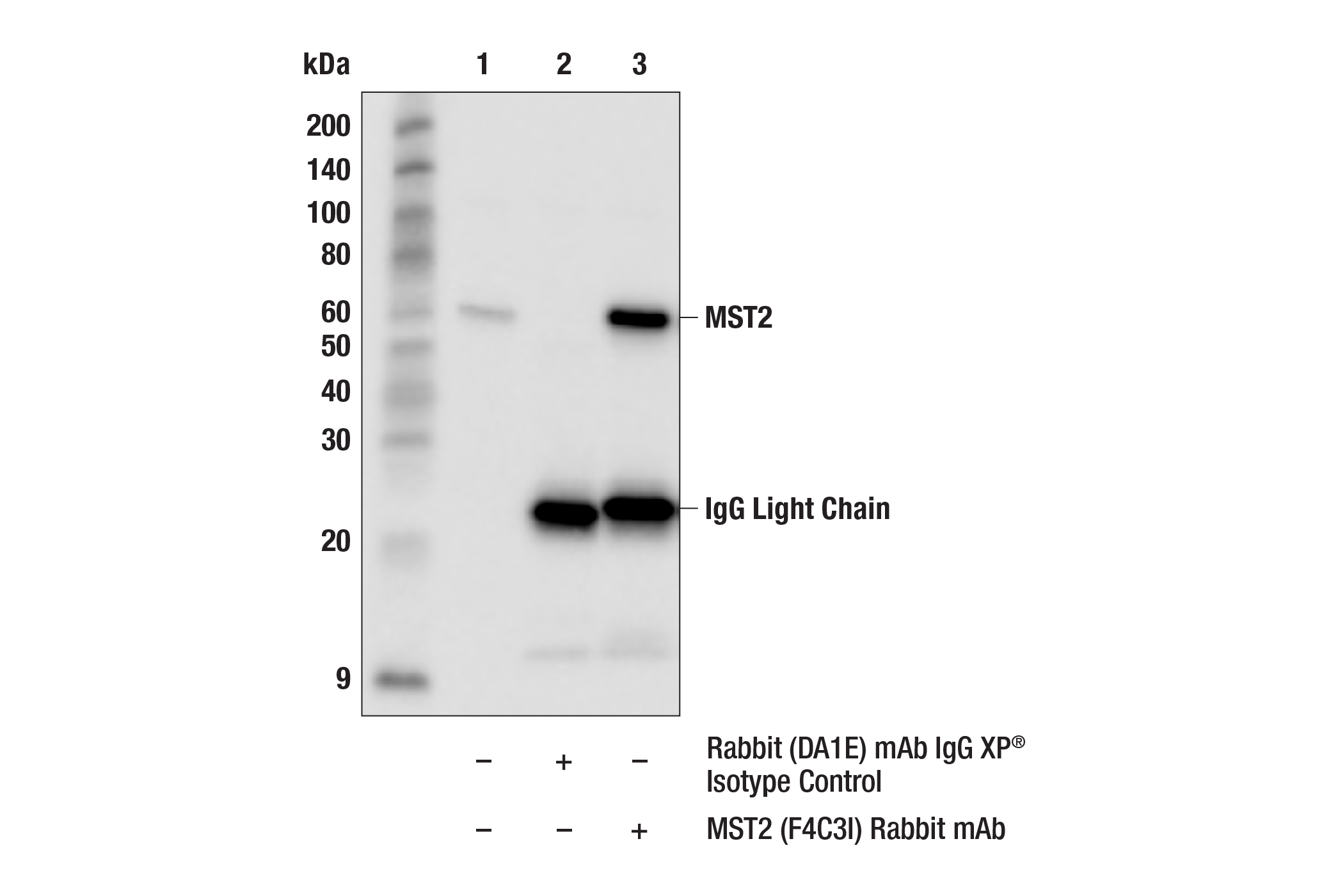 Immunoprecipitation Image 1: MST2 (F4C3I) Rabbit Monoclonal Antibody
