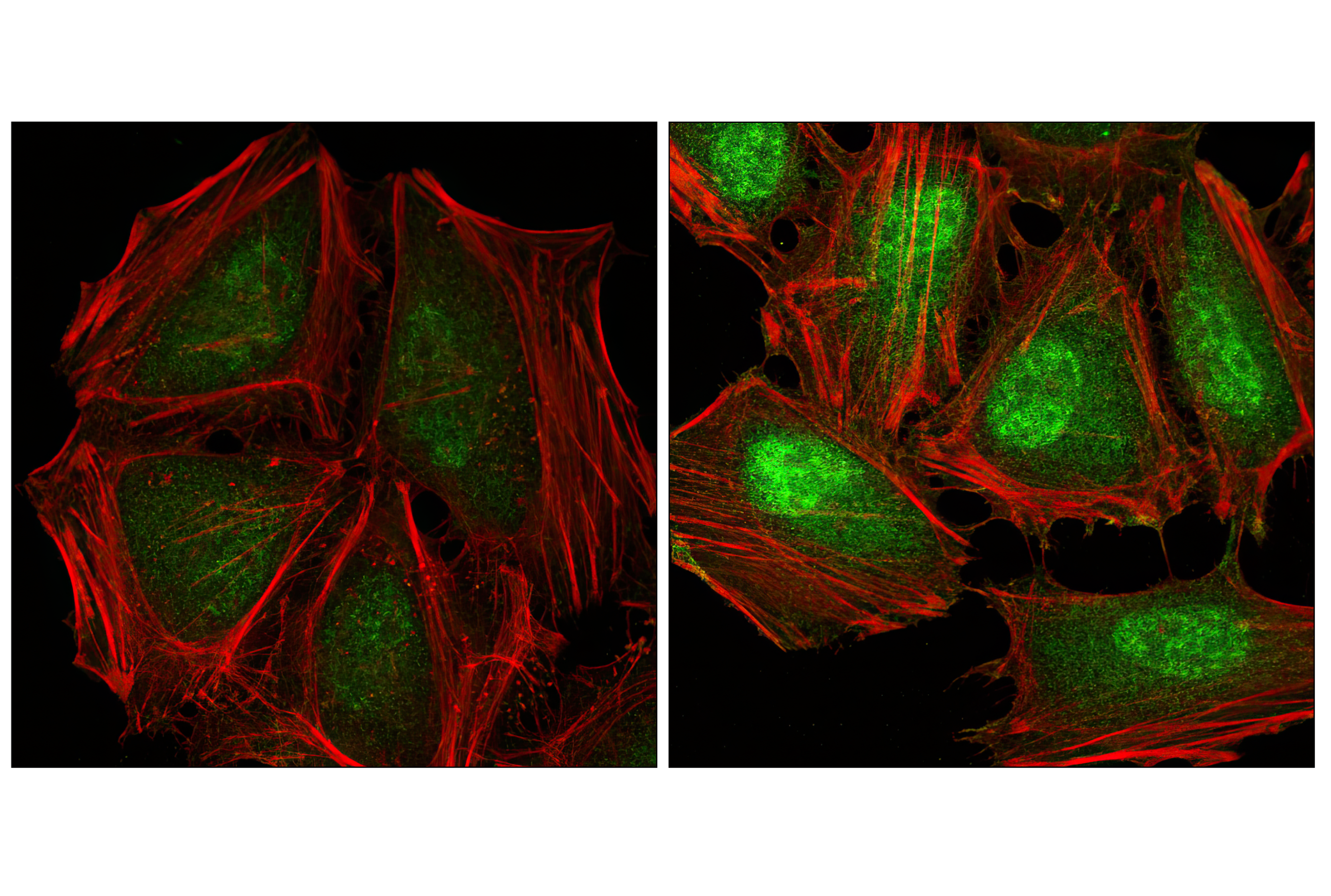 Immunofluorescence Image 1: Phospho-p38 MAPK (Thr180/Tyr182) (28B10) Mouse mAb (BSA and Azide Free)