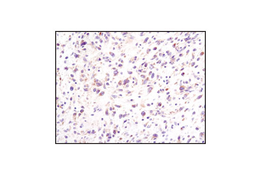 Immunohistochemistry Image 1: eIF4G (C45A4) Rabbit mAb
