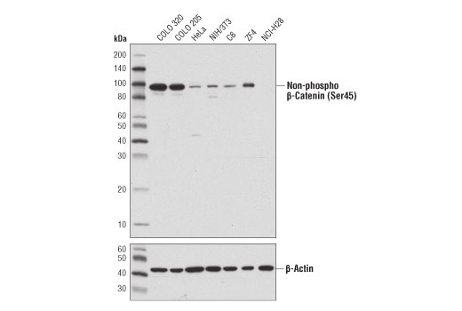 Western Blotting Image 1: Non-phospho (Active) β-Catenin (Ser45) (D2U8Y) XP® Rabbit mAb (BSA and Azide Free)