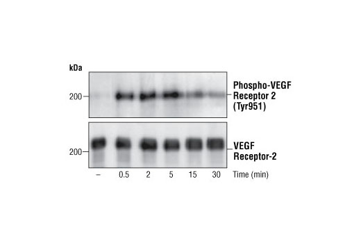Western Blotting Image 1: Phospho-VEGF Receptor 2 (Tyr951) Antibody