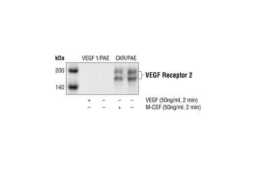 Western Blotting Image 1: VEGF Receptor 2 Antibody