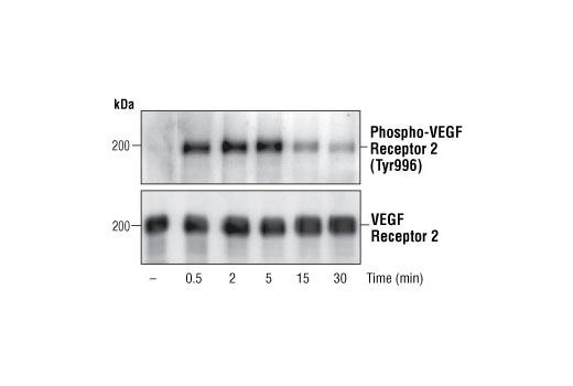  Image 1: Phospho-VEGF Receptor 2 Antibody Sampler Kit