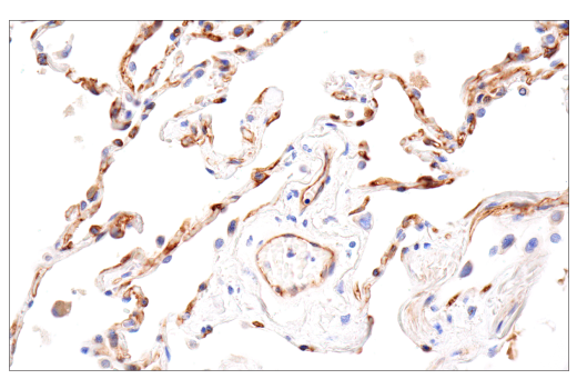 Immunohistochemistry Image 5: CD109 (E4I2V) Rabbit mAb