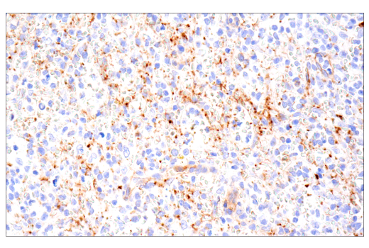 Immunohistochemistry Image 9: CD109 (E4I2V) Rabbit mAb