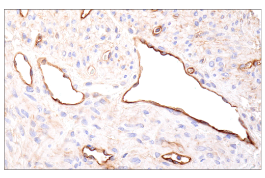 Immunohistochemistry Image 10: CD109 (E4I2V) Rabbit mAb