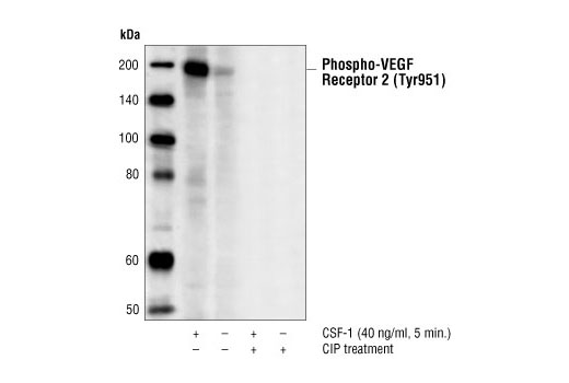 Western Blotting Image 1: Phospho-VEGF Receptor 2 (Tyr951) (7H11) Mouse mAb