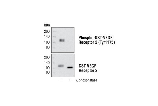 Western Blotting Image 1: Phospho-VEGF Receptor 2 (Tyr1212) (11A3) Rabbit mAb
