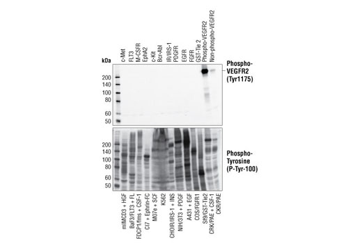 Western Blotting Image 1: Phospho-VEGF Receptor 2 (Tyr1175) (19A10) Rabbit mAb