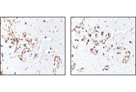 Immunohistochemistry Image 2: VEGF Receptor 2 (55B11) Rabbit mAb