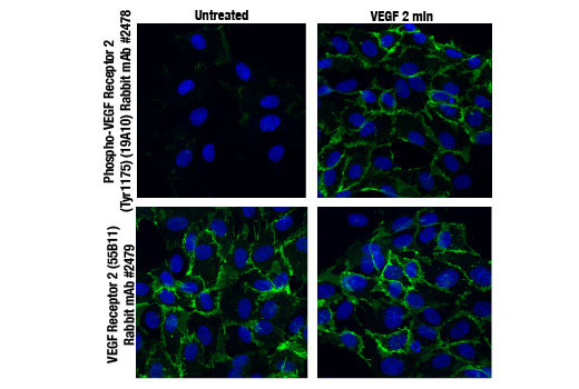 Immunofluorescence Image 2: VEGF Receptor 2 (55B11) Rabbit mAb