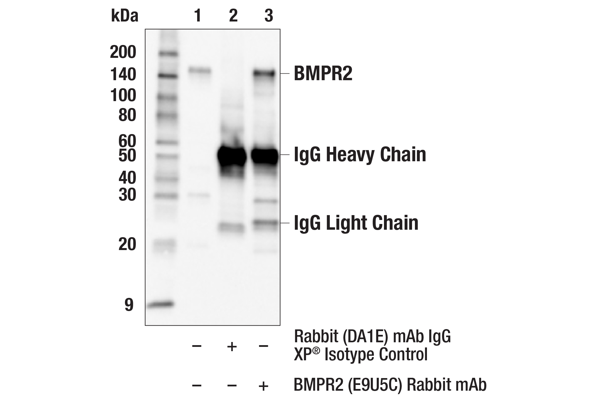Immunoprecipitation Image 1: BMPR2 (E9U5C) Rabbit mAb