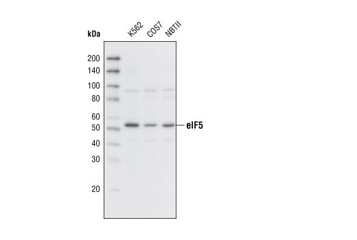 Western Blotting Image 1: eIF5 Antibody