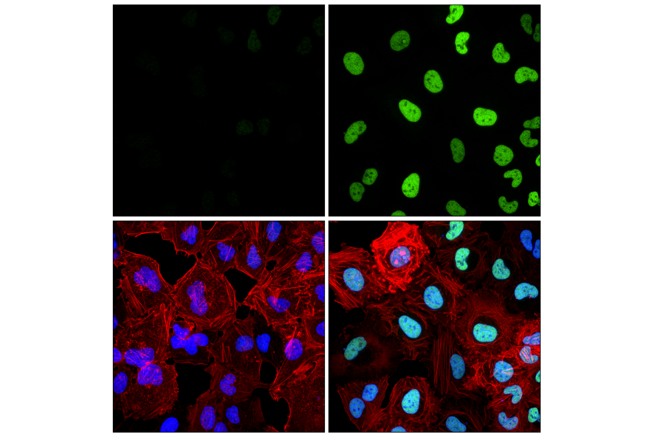 Immunofluorescence Image 1: FRA1 (F2C9L) Rabbit mAb