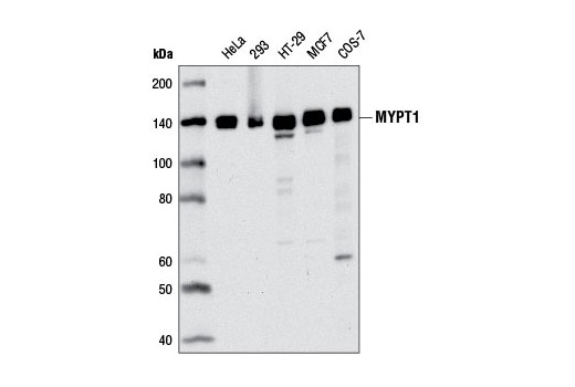 Western Blotting Image 1: MYPT1 (D6C1) Rabbit mAb (BSA and Azide Free)