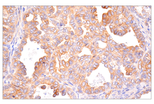 Immunohistochemistry Image 6: MYPT1 (D6C1) Rabbit mAb (BSA and Azide Free)