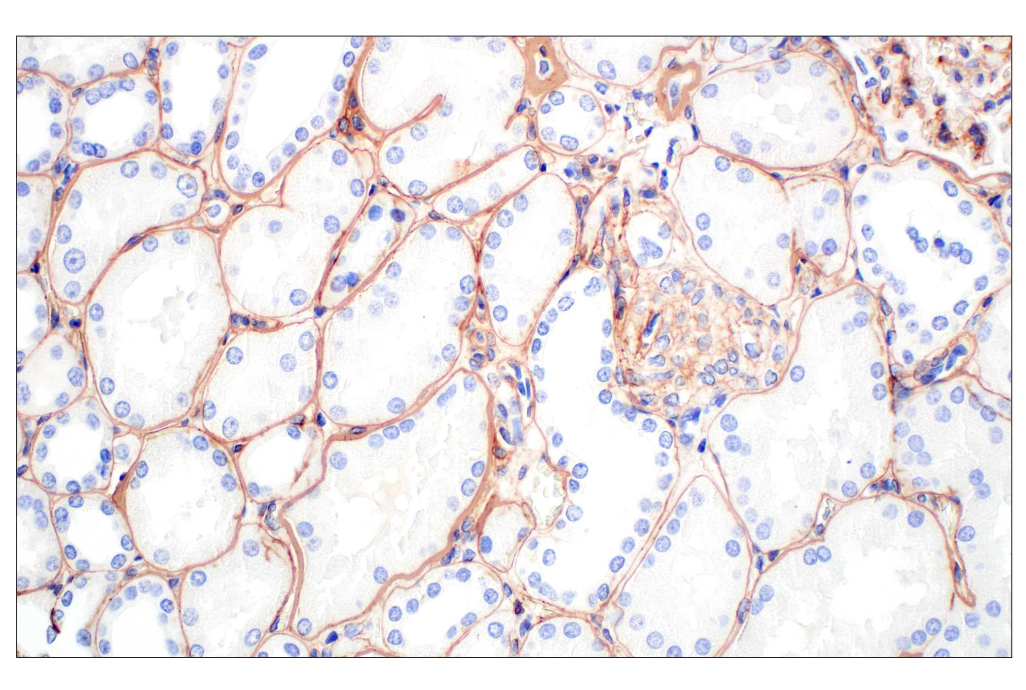 Immunohistochemistry Image 6: COL4A1 (E5M6R) Rabbit mAb (BSA and Azide Free)