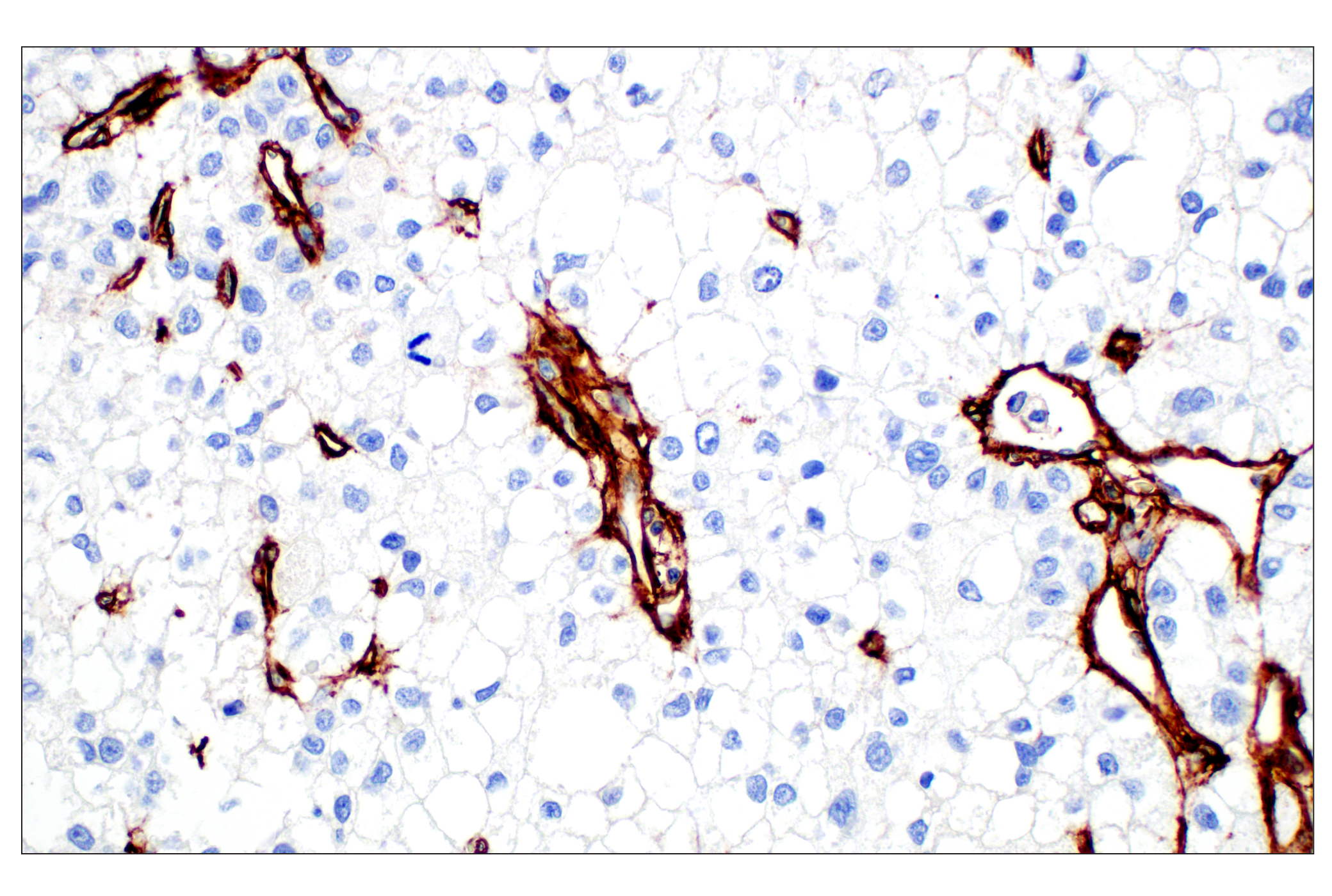 Immunohistochemistry Image 1: COL4A1 (E5M6R) Rabbit mAb (BSA and Azide Free)