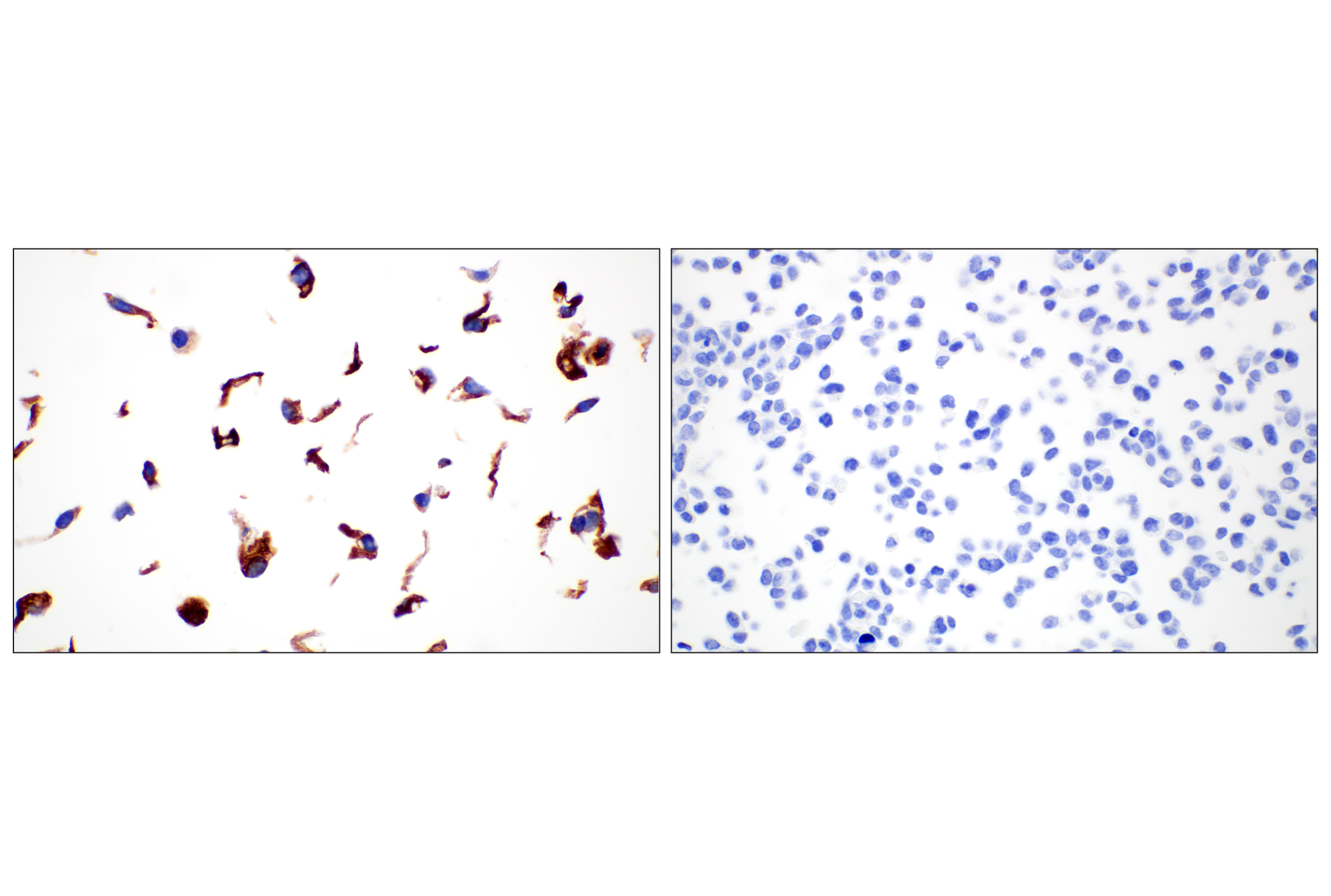 Immunohistochemistry Image 9: COL4A1 (E5M6R) Rabbit mAb (BSA and Azide Free)
