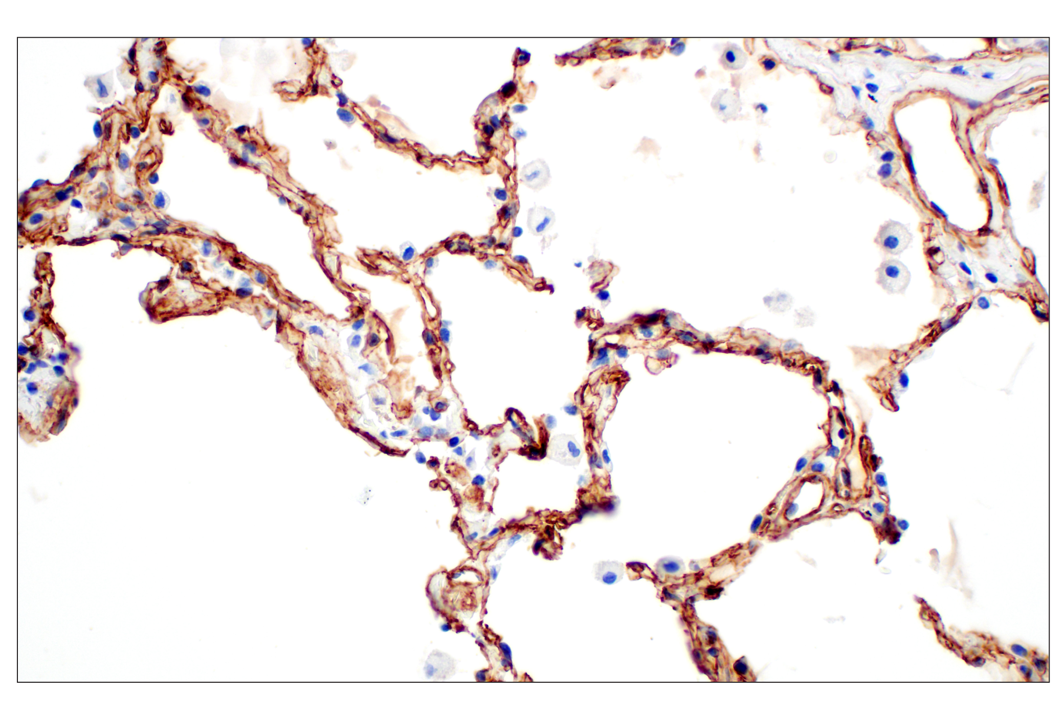Immunohistochemistry Image 5: COL4A1 (E5M6R) Rabbit mAb (BSA and Azide Free)