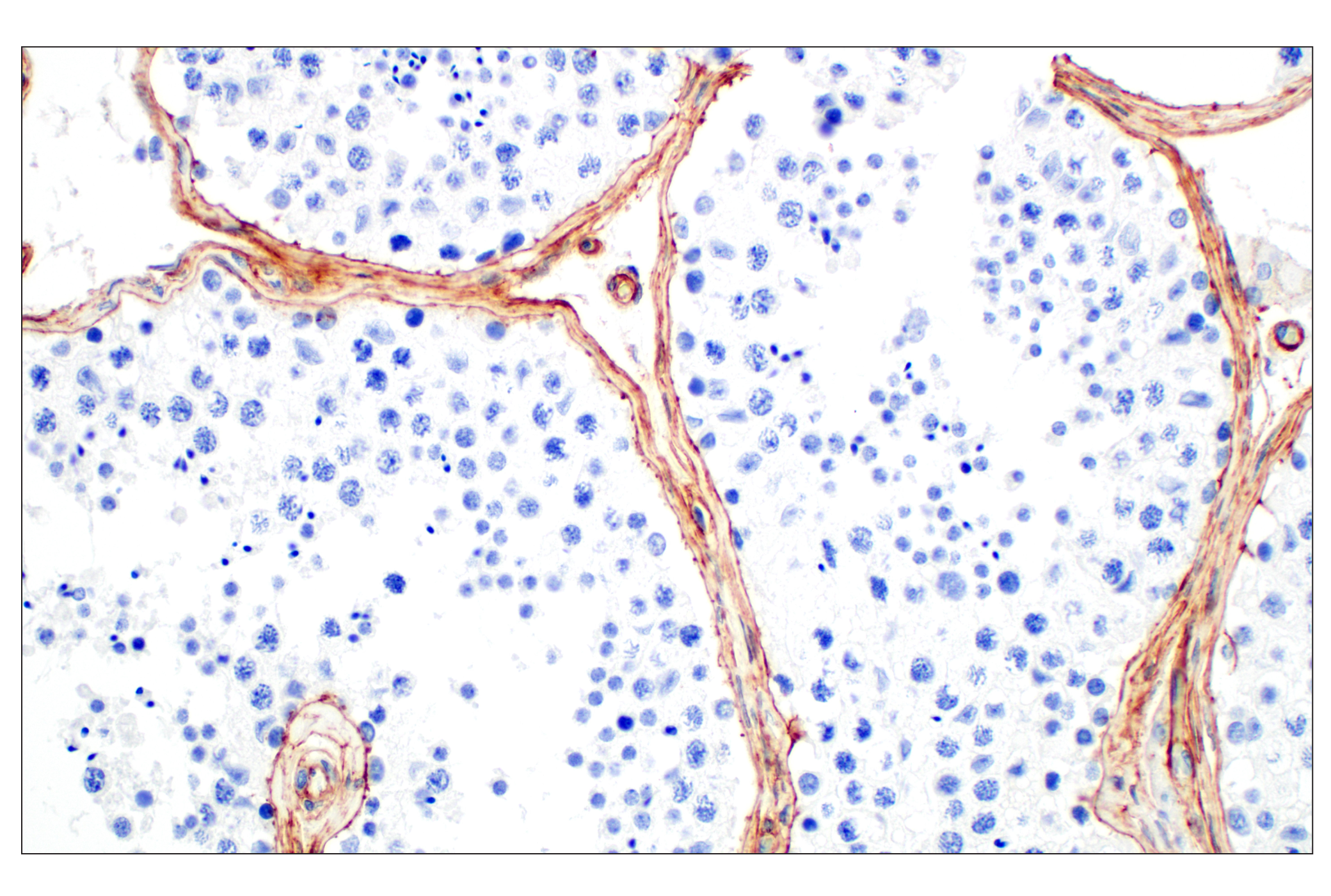 Immunohistochemistry Image 7: COL4A1 (E5M6R) Rabbit mAb (BSA and Azide Free)