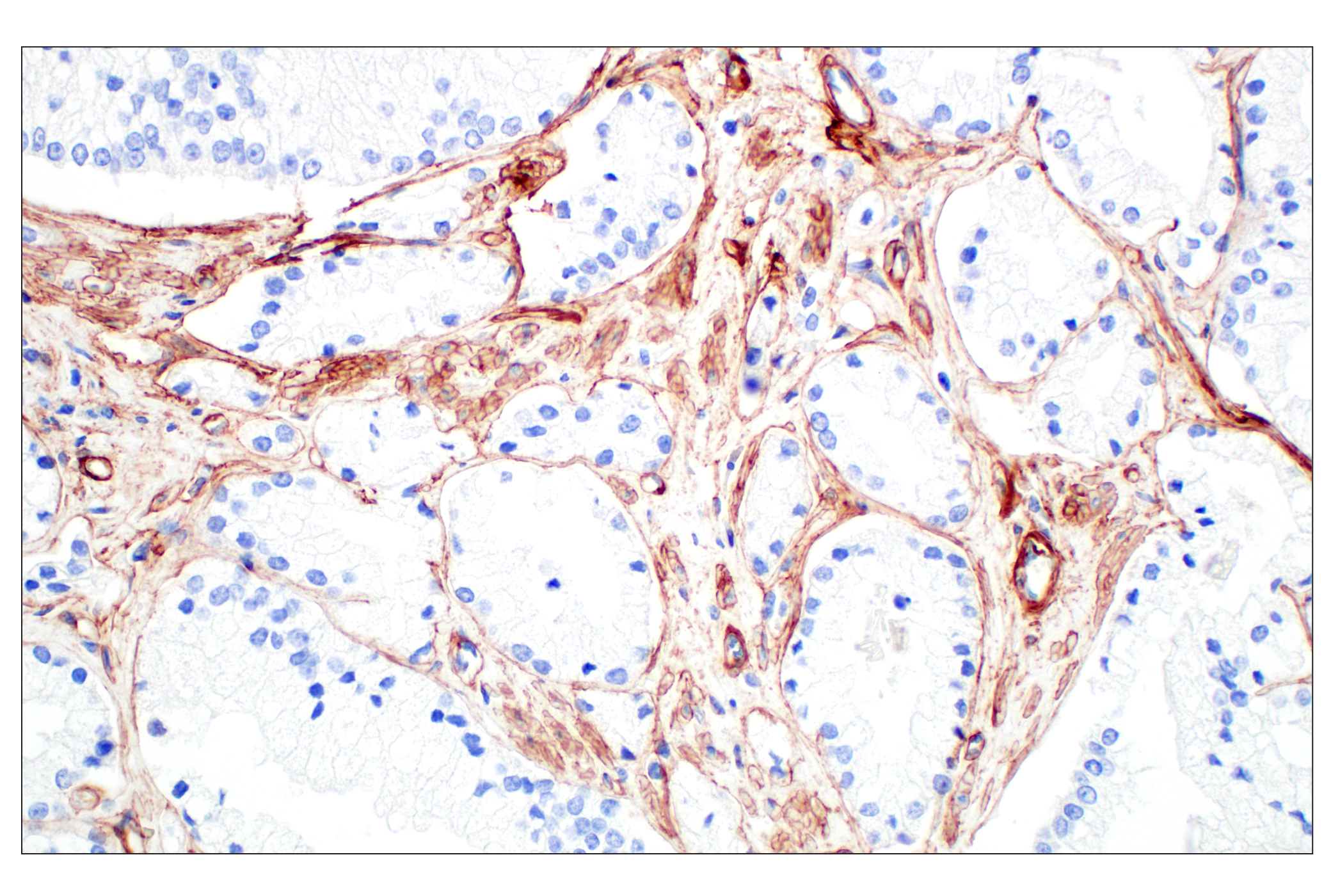 Immunohistochemistry Image 2: COL4A1 (E5M6R) Rabbit mAb (BSA and Azide Free)