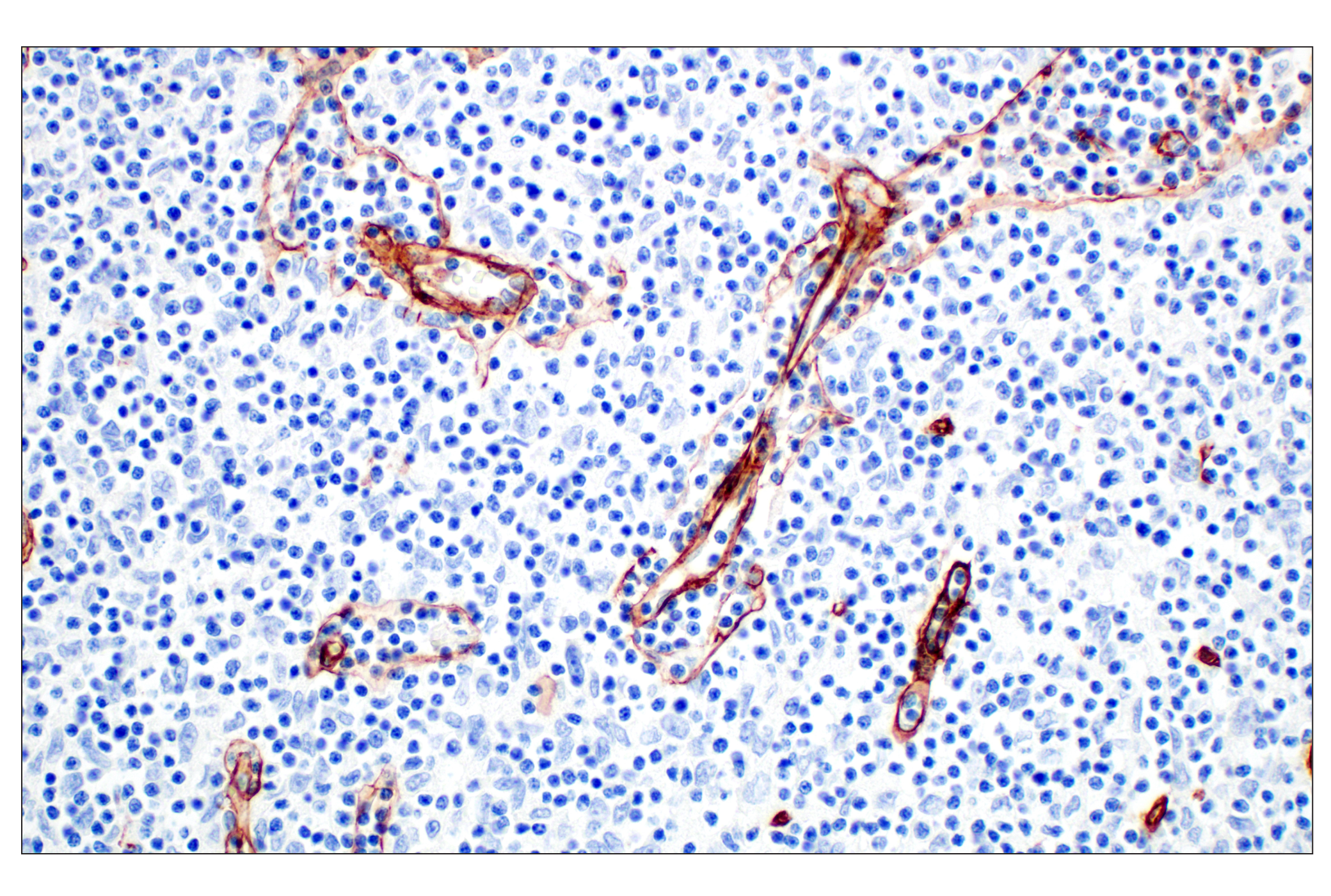 Immunohistochemistry Image 4: COL4A1 (E5M6R) Rabbit mAb (BSA and Azide Free)