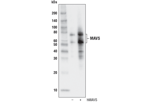  Image 5: MAVS Signalosome Antibody Sampler Kit
