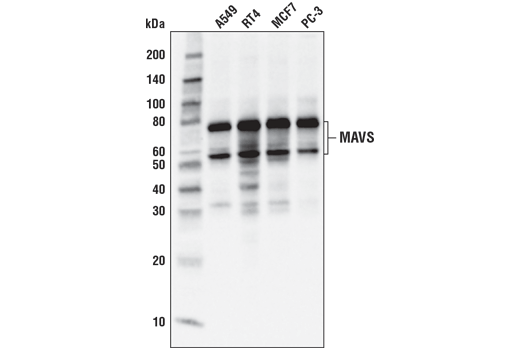  Image 18: MAVS Signalosome Antibody Sampler Kit
