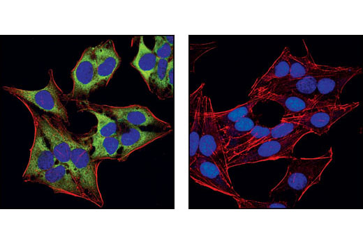 Immunofluorescence Image 1: eIF4G Antibody