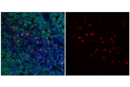 Immunofluorescence Image 1: NK1.1/CD161 (E6Y9G) Rabbit mAb (Alexa Fluor® 647 Conjugate)