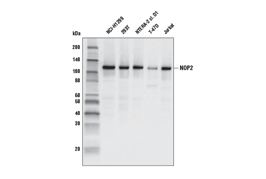 Western Blotting Image 1: NOP2 (G754) Antibody