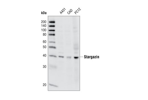 Western Blotting Image 1: Stargazin Antibody