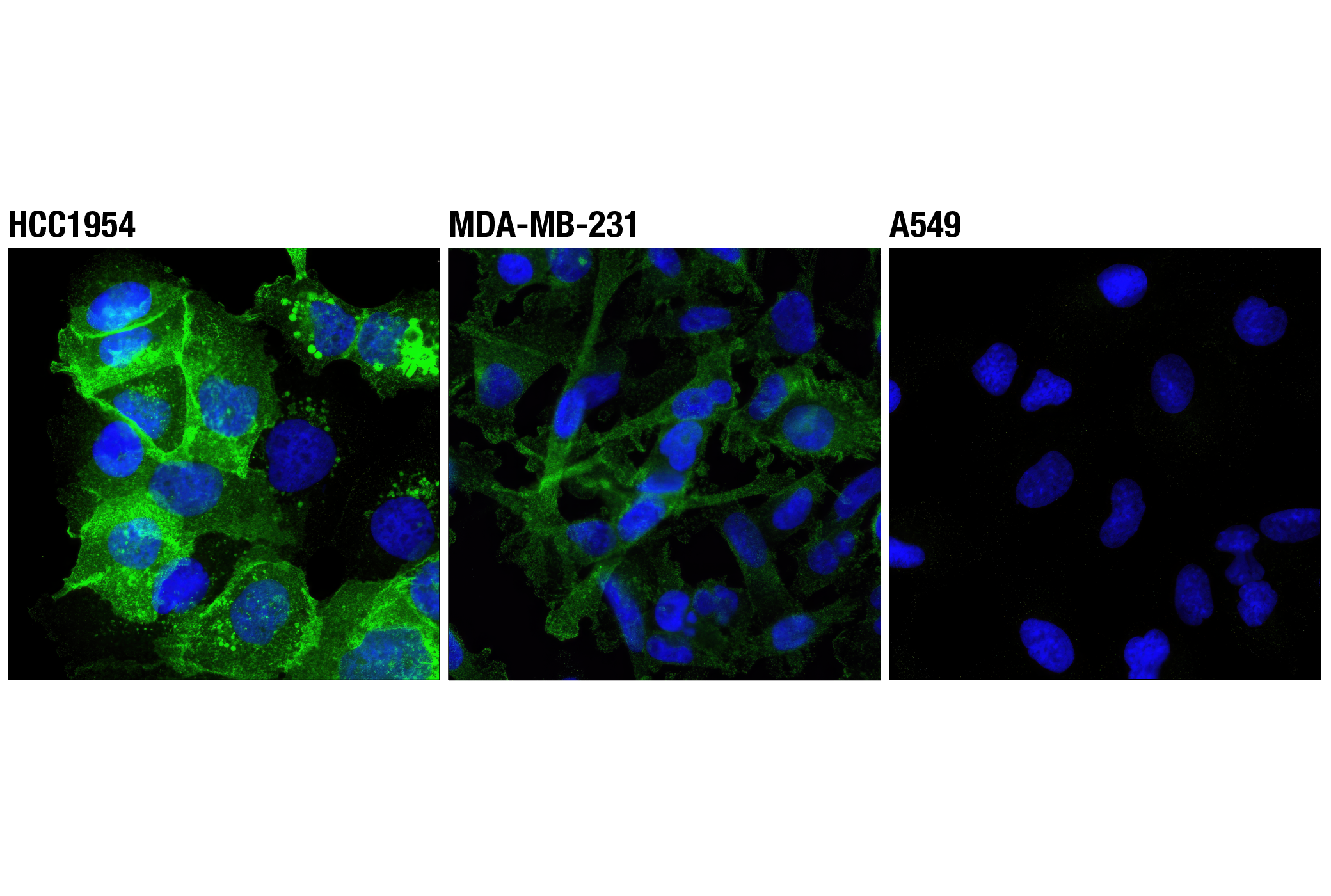 Immunofluorescence Image 1: PD-L1 (Extracellular Domain Specific) (D8T4X) Rabbit mAb (Alexa Fluor® 488 Conjugate)