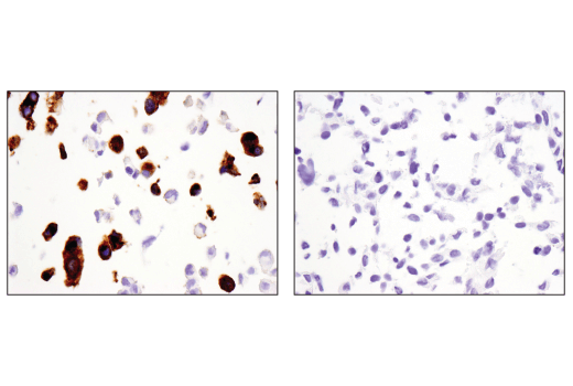 Immunohistochemistry Image 1: Synaptophysin (D8F6H) XP® Rabbit mAb (BSA and Azide Free)