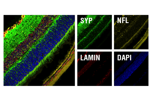 Immunofluorescence Image 1: Synaptophysin (D8F6H) XP® Rabbit mAb (BSA and Azide Free)