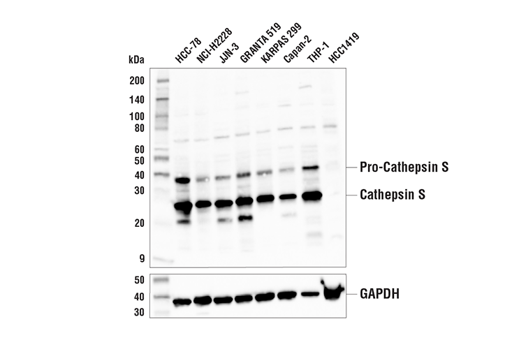 Western Blotting Image 1: Cathepsin S Antibody