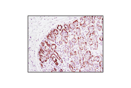 Immunohistochemistry Image 1: TrkA (14G6) Rabbit mAb