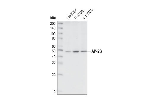 Western Blotting Image 1: AP-2β Antibody