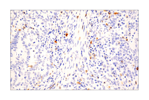 Immunohistochemistry Image 3: TNFRSF8/CD30 (E7E4D) XP® Rabbit mAb