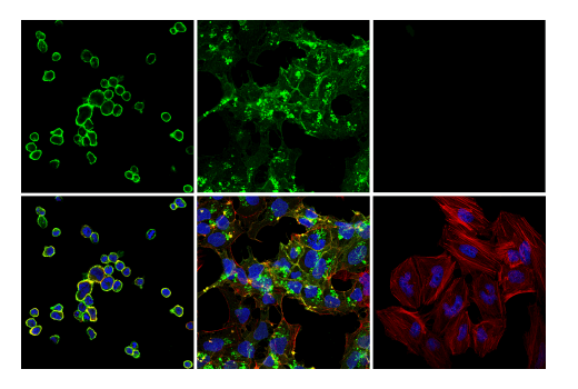 Immunofluorescence Image 1: TNFRSF8/CD30 (E7E4D) XP® Rabbit mAb