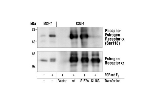 Western Blotting Image 1: Phospho-Estrogen Receptor α (Ser118) (16J4) Mouse mAb