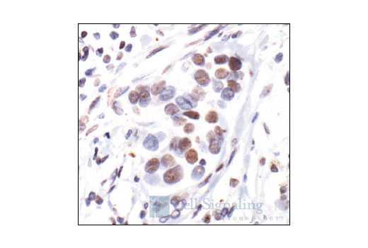  Image 9: Estrogen Receptor α Activation Antibody Sampler Kit