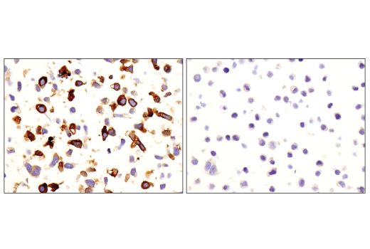 Immunohistochemistry Image 8: CD163 (D6U1J) Rabbit mAb (BSA and Azide Free)