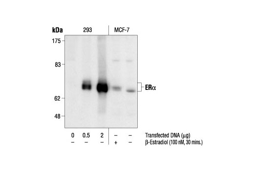 Western Blotting Image 1: Estrogen Receptor α (62A3) Mouse mAb
