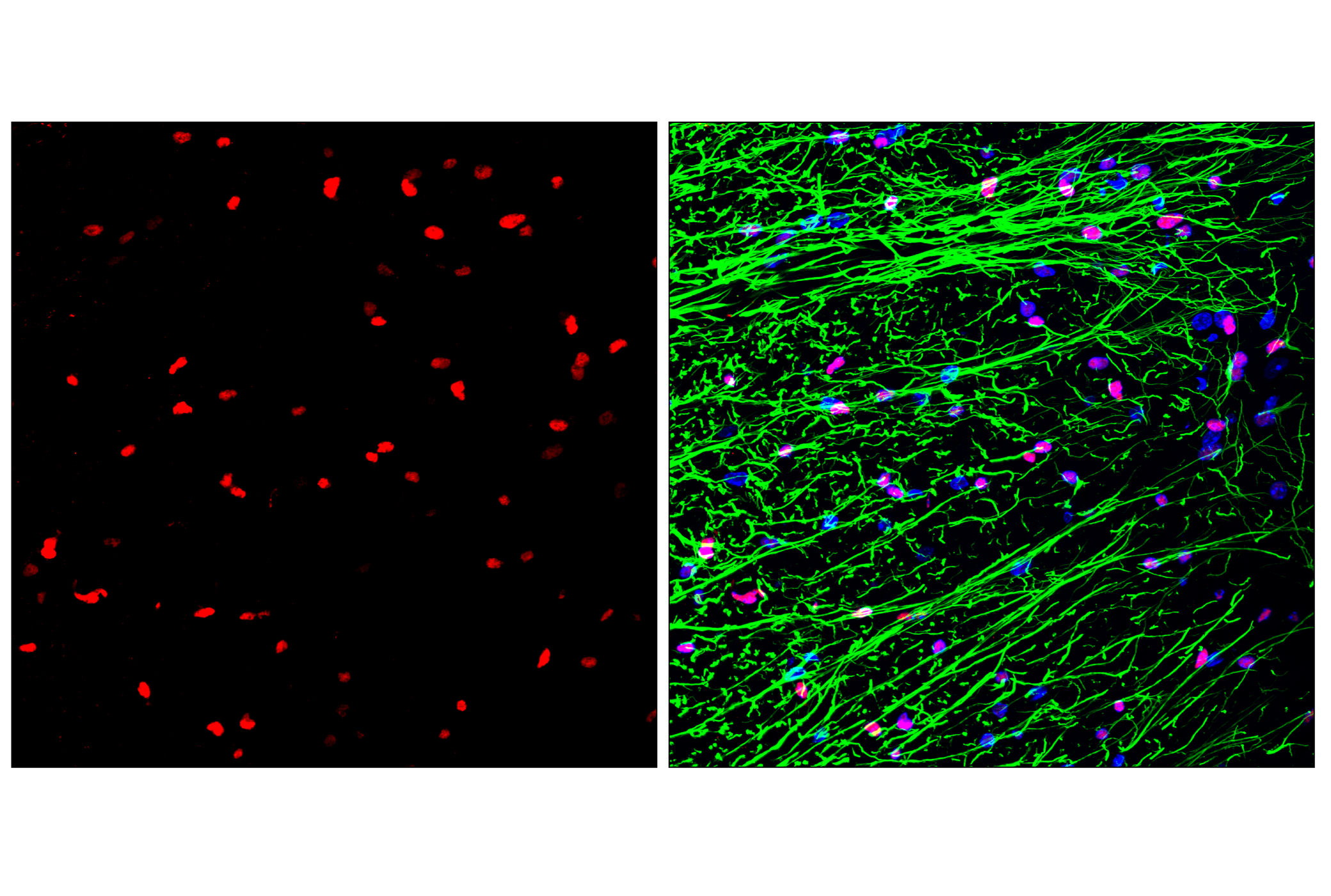 Immunofluorescence Image 2: Olig2 (E6G6Q) XP® Rabbit mAb (Alexa Fluor® 555 Conjugate)