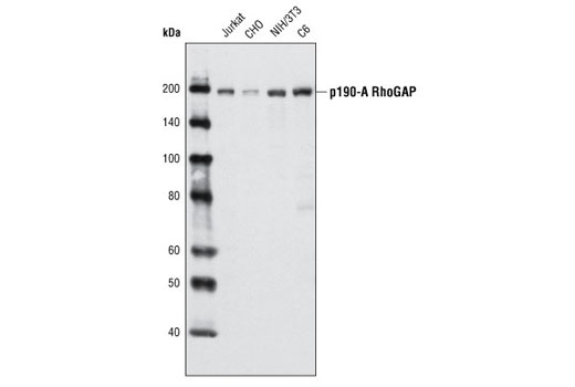 Western Blotting Image 1: p190-A RhoGAP Antibody
