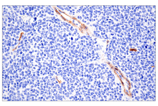 Immunohistochemistry Image 5: NG2/CSPG4 (E3B3G) XP® Rabbit mAb (BSA and Azide Free)