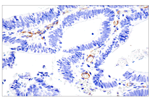 Immunohistochemistry Image 6: NG2/CSPG4 (E3B3G) XP® Rabbit mAb (BSA and Azide Free)